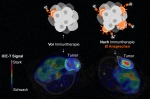 Before immunotherapy weak ICE-T signals in the tumour in blue and green, after immunotherapy strong signals in red and pink.